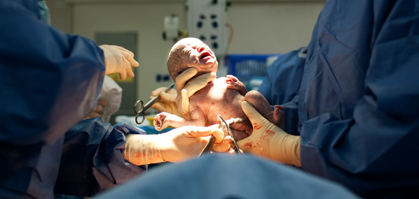 What to Expect in a Cesarean Birth