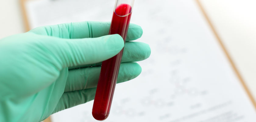 Is Cord Blood Banking Worth It?