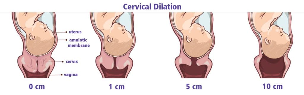 How to insert evening primrose oil into cervix