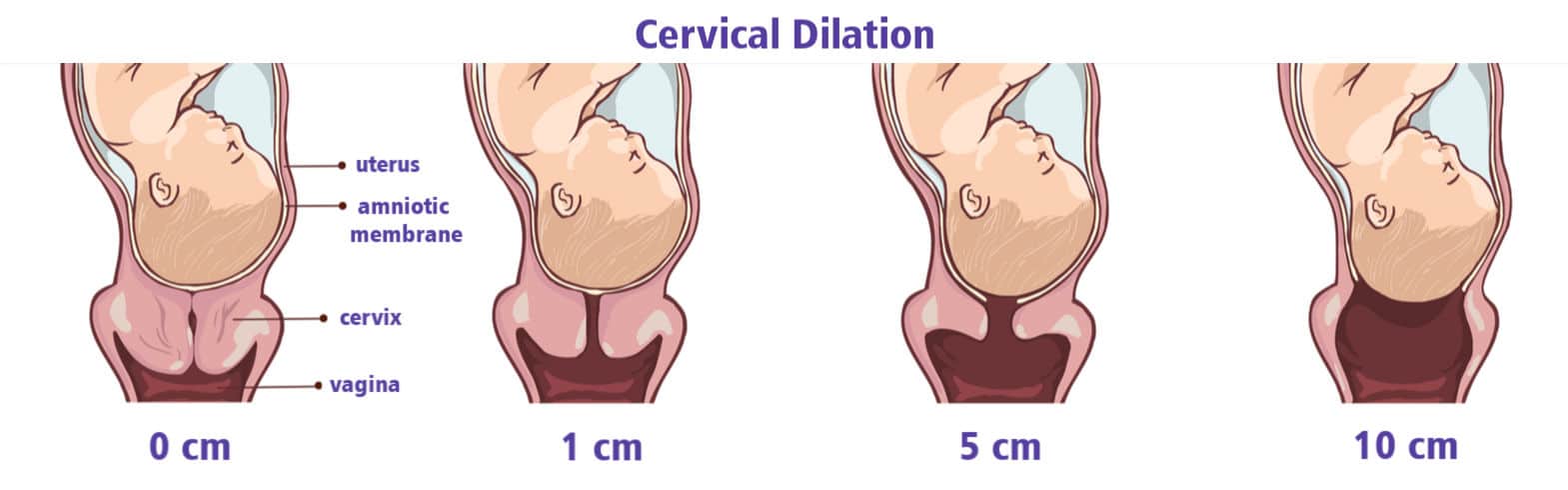 The Evidence On Vaginal Exams Before And During Labor Pregnancy Podcast 